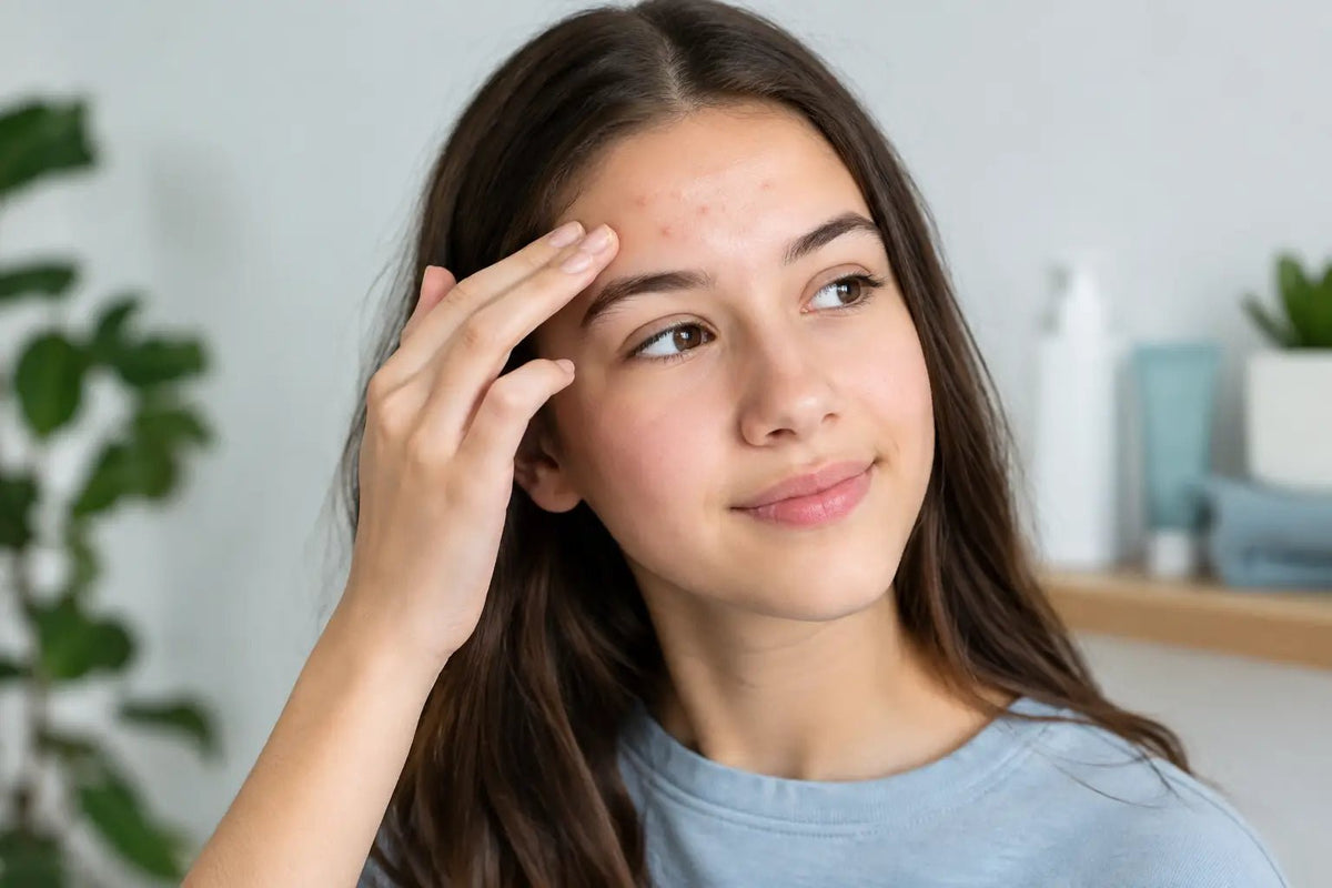Forehead Bumps in Teens and a Gentle Routine - Bestie Skin Club